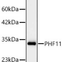 [KD Validated] PHF11 Rabbit mAb