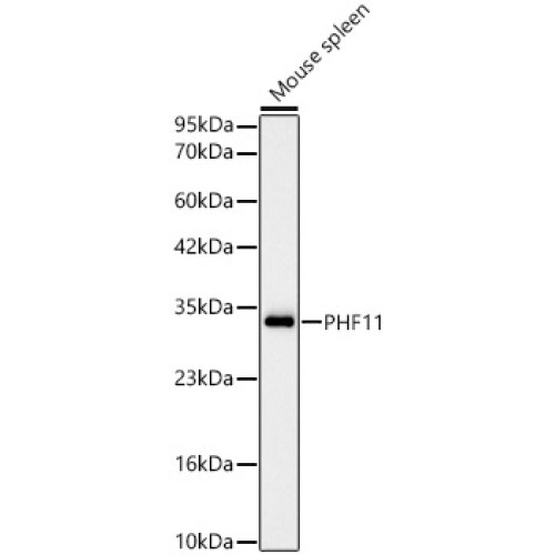 [KD Validated] PHF11 Rabbit mAb