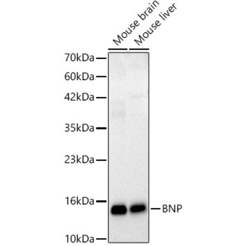 BNP Rabbit mAb