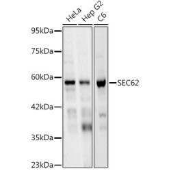 SEC62 Rabbit mAb