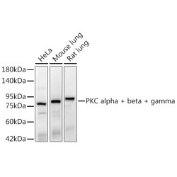 PKC alpha + beta + gamma Rabbit mAb