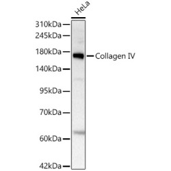 Collagen IV Rabbit mAb
