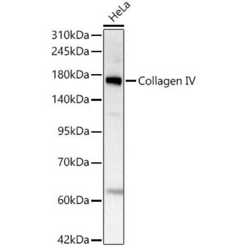 Collagen IV Rabbit mAb