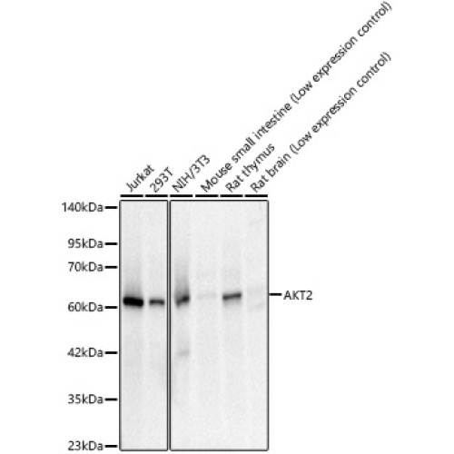 AKT2 Rabbit mAb