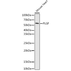 PLGF Rabbit mAb