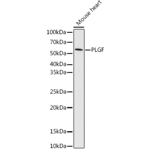PLGF Rabbit mAb