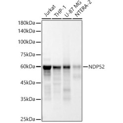 [KD Validated] NDP52 Rabbit mAb