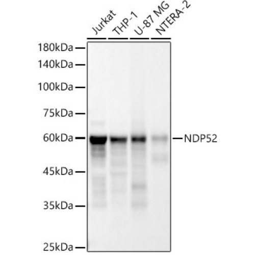 [KD Validated] NDP52 Rabbit mAb