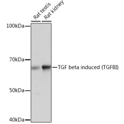 TGF beta induced (TGFBI) Rabbit mAb