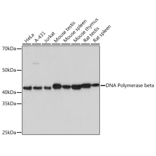DNA Polymerase beta Rabbit mAb