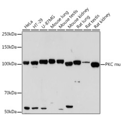 PKC mu Rabbit mAb