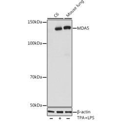 MDA5 Rabbit mAb