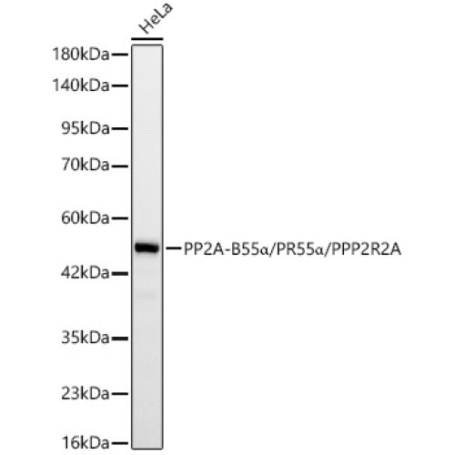 PP2A-B55α/PR55α/PPP2R2A Rabbit mAb