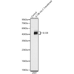 IL12B Rabbit mAb