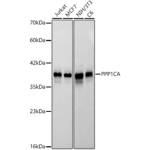 PPP1CA Rabbit mAb