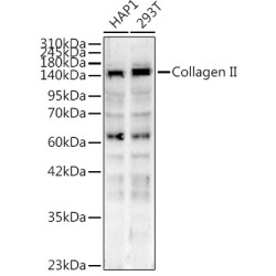 Collagen II Rabbit pAb