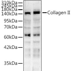Collagen II Rabbit pAb