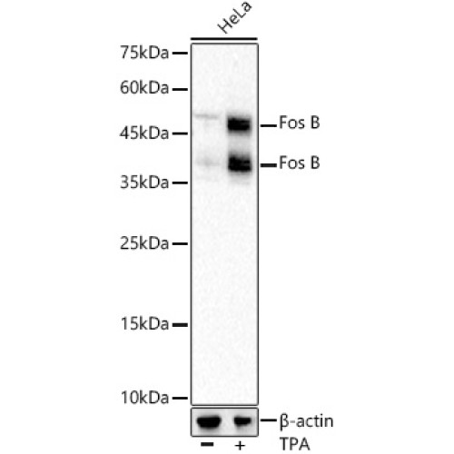 Fos B Rabbit mAb