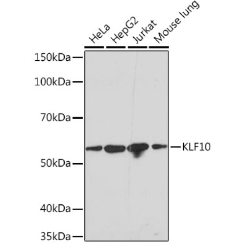 KLF10 Rabbit mAb