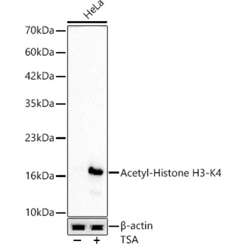 Acetyl-Histone H3-K4 Rabbit mAb