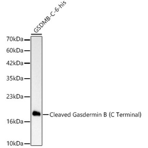 Cleaved Gasdermin B（C Terminal） Rabbit mAb