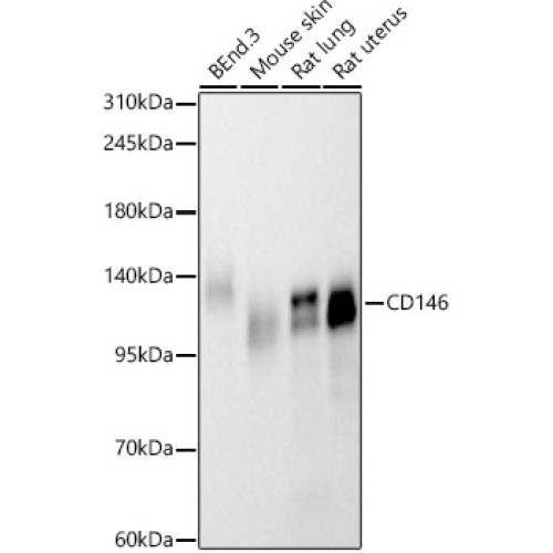 CD146 Rabbit mAb
