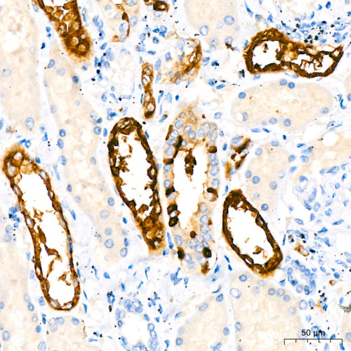 Flt3/CD135 Rabbit mAb