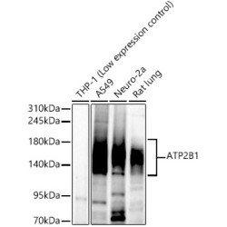 ATP2B1 Rabbit mAb