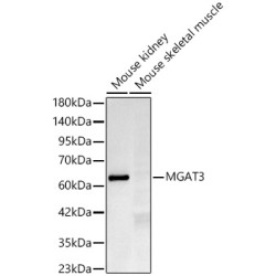 MGAT3 Rabbit mAb