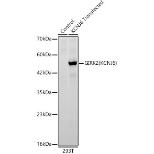 GIRK2(KCNJ6) Rabbit mAb