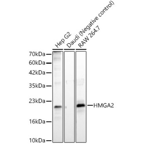 HMGA2 Rabbit mAb