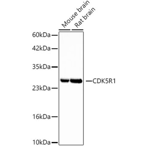 CDK5R1 Rabbit mAb