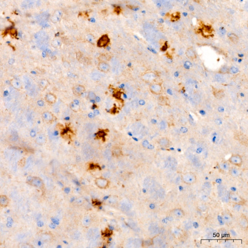 β-Amyloid(1-42) Rabbit mAb