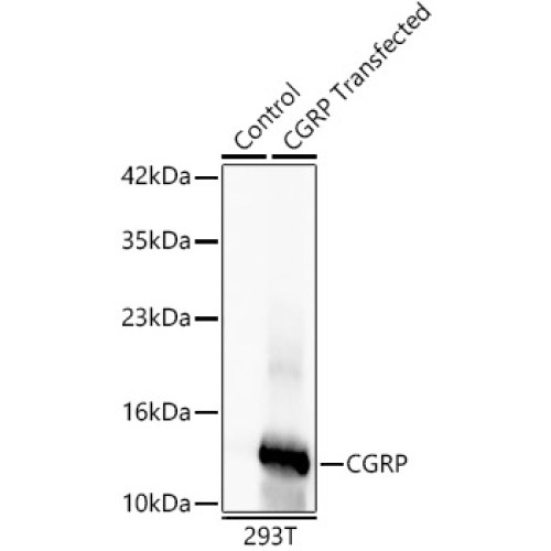 CGRP Rabbit mAb