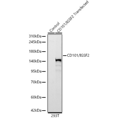 CD101/IGSF2 Rabbit mAb