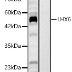 LHX6 Rabbit pAb
