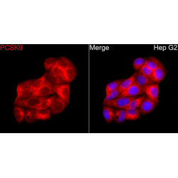 PCSK9 Rabbit pAb