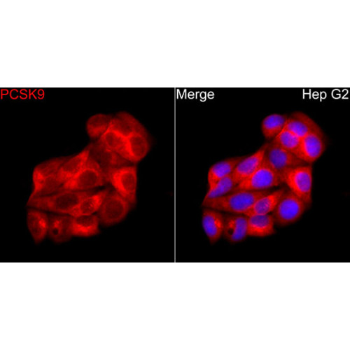PCSK9 Rabbit pAb