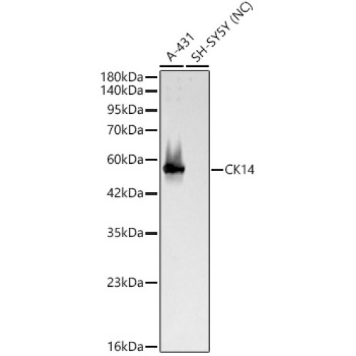 CK14 Rabbit pAb