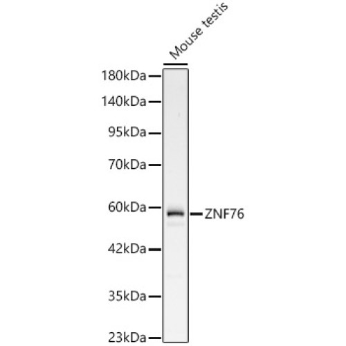 ZNF76 Rabbit pAb