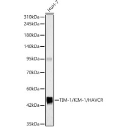 TIM-1/KIM-1/HAVCR Rabbit pAb