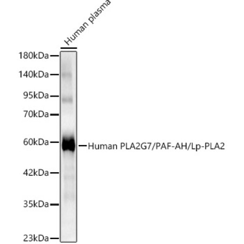 Human PLA2G7/PAF-AH/Lp-PLA2 Rabbit pAb
