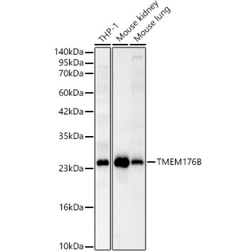 TMEM176B Rabbit pAb