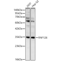 RNF126 Rabbit pAb