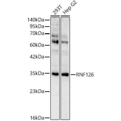 RNF126 Rabbit pAb