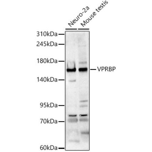 VPRBP Rabbit pAb