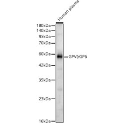 GPVI/GP6 Rabbit pAb