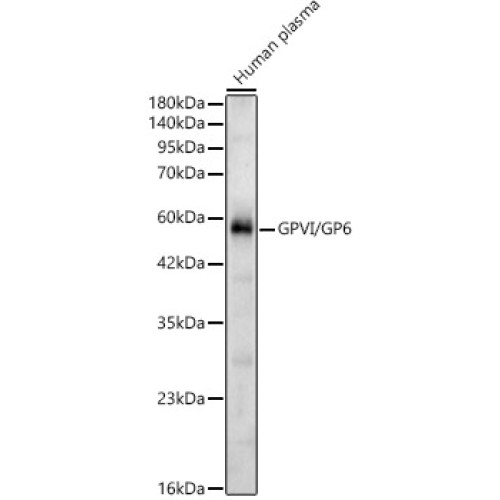 GPVI/GP6 Rabbit pAb