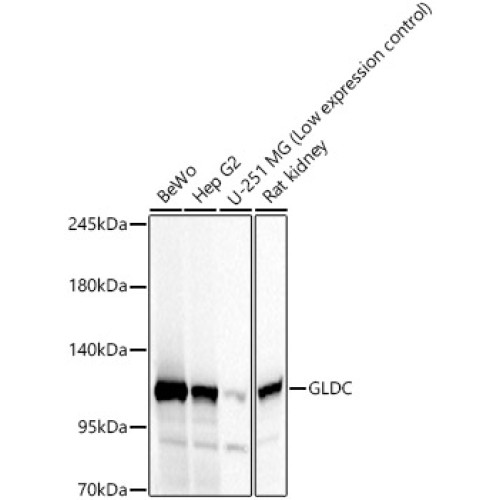 GLDC Rabbit pAb