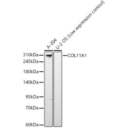 COL11A1 Rabbit mAb